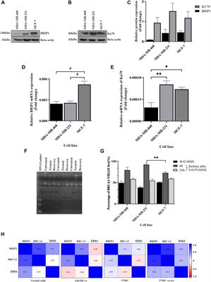 BRCA1 interactors, RAD50 and BRIP1, as prognostic markers for triple-negative breast cancer severity